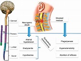 Neurogenic Shock - Homecare24