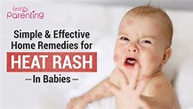 8 Simple Home Remedies for Heat Rash On Babies - YouTube