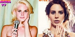 Lana del Rey, 'Summertime Sadness'. La cantante prima della chirurgia ...