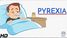 Pyrexia or Fever: Everything You Need to Know - YouTube
