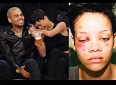 Chris Brown Regretfully Recounts How He Assaulted Rihanna in New ...