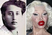 Amanda Lepore's Multiple Plastic Surgery Led to Disaster – Before and ...