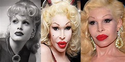 Amanda Lepore Plastic Surgery Before and After Pictures 2019