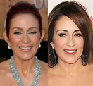 Has Patricia Heaton had Plastic Surgery Done Before and After Pictures