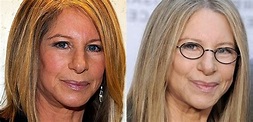 Barbra Streisand Plastic Surgery Before And After Photos