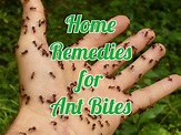 18 Useful Home Remedies For Ant Bites