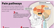 Infographic : Pain Pathways