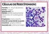 Células de Reed Stemberg | Hematología, Histología, Ganglios linfaticos