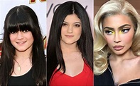 Kylie Jenner: El antes y el después de la fama - CHIC Magazine