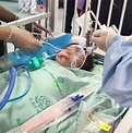 成都崇州被狗咬傷女童已出院，身體各系統恢復順利 - 新浪香港