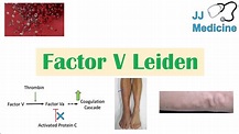Factor V Leiden | Causes, Pathophysiology, Symptoms, Diagnosis ...
