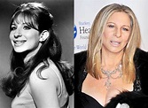 Barbra Streisand Plastic Surgery Before and After Photos | Celebrity ...