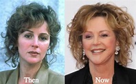 Bonnie Bedelia Plastic Surgery Rumors Before and After Photos - Latest ...