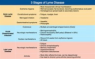 3 Stages of Lyme Disease Early Lyme Disease - ... | GrepMed