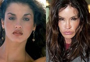 Janice Dickinson before and after plastic surgery 01 – Celebrity ...