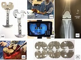 Sensor-guided technology helps to reproduce medial pivot kinematics in ...