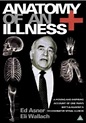 Anatomy of an Illness (1984) - Poster US - 331*475px