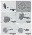 Figure 3 from Identification of Entamoeba histolytica trophozoites in ...