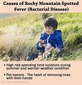 Rocky Mountain Spotted Fever - Causes, Symptoms, Diagnosis, Treatment