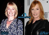 Marg Helgenberger Plastic Surgery Before and After - Plastic Surgery Facts
