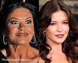 Catherine Zeta Jones Botox Fake Celebrities, Celebrities Before And ...