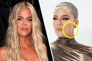 Khloé Kardashian Gave An Update On Her Facial Tumor Scar After Wearing ...