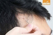 一日洗頭X次防脫髮！韓國醫生大推「2.2.2 洗頭法」頭皮清潔最重要｜好生活百科 | 好生活百科 | 新假期