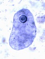 Parasitology - Entamoeba coli? | Entamoeba histolytica, Medical ...