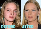 Uma Thurman Plastic Surgery Before and After Picture - Lovely Surgery ...