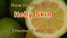Skin Itching Treatment at Home with Vitamin C Powder-Stop Itchy Skin ...
