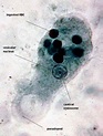 Entamoeba Histolytica Trophozoite