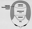 3 Regions of the scalp anterior to the vertex transition point ...