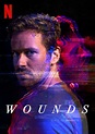 Wounds | Netflix Wiki | Fandom