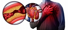 What is heart attack disease and how to treat it?