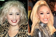 Gwen Stefani Before and After Plastic Surgery Including Botox and Boob ...