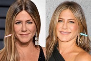 Jennifer Aniston Plastic Surgery: Before and After Pictures