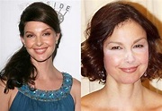 Ashley Judd before and after Plastic Surgery (8) – Celebrity plastic ...