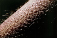 Close-up Of Goose Bumps On Skin Of Forearm Photograph by Martin Dohrn ...