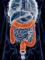 Human colon - Stock Image - F016/3070 - Science Photo Library
