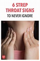 6 Strep Throat Signs to Never Ignore | Signs of strep throat, Strep ...