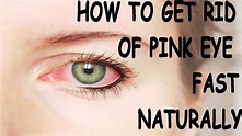 How to get Rid of Pink Eye Fast- Conjunctivitis Naturally. The Best ...