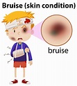 A Boy Having Bruise on Face 300862 Vector Art at Vecteezy