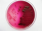E. coli (Escherichia coli)- An Overview - Microbe Notes
