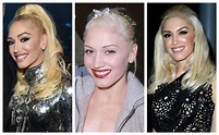 Did Gwen Stefani Get Plastic Surgery? See What Experts Think