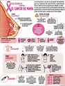 Infografía: Día Mundial contra El Cáncer de Mama | ELHERALDO.CO