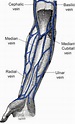 cephalic vein thrombus - ModernHeal.com