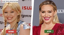 Did Hilary Duff Has Undergone Plastic Surgery? Her Before And After ...