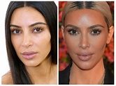 Kim Kardashian Before And After: Plastic Surgery Timeline
