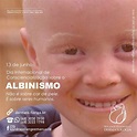 13 de junho – Dia Mundial de Conscientização sobre o Albinismo ...