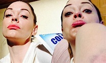 Accident-prone Rose McGowan shares ghastly photos of her recent bruises ...